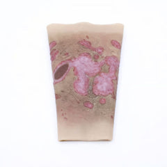 TRAUMASIM Wearable Burn Wound Simulator: Realistic Forearm Trauma Training Aid