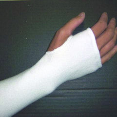 Coolmax splint sock with thumb spica worn on the hand