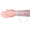 Image of PALS electrodes placed on the forearm